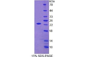 Image no. 1 for Apolipoprotein O (APOO) (AA 26-198) protein (His tag) (ABIN4989991) (APOO Protein (AA 26-198) (His tag))