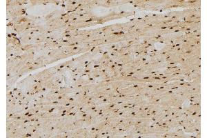 ABIN6277705 at 1/100 staining Rat heart tissue by IHC-P. (PSMB4 antibody  (Internal Region))