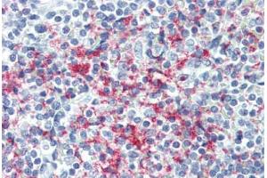 Human Spleen (formalin-fixed, paraffin-embedded) stained with GP1BB antibody ABIN396968 at 1:50 followed by biotinylated anti-mouse IgG secondary antibody ABIN481714, alkaline phosphatase-streptavidin and chromogen. (GP1BB antibody)
