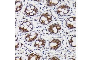 Immunohistochemistry of paraffin-embedded human colon using Monoamine Oxidase B (MAOB) Rabbit pAb (ABIN3022151, ABIN3022152, ABIN3022153, ABIN1513172 and ABIN6218632) at dilution of 1:150 (40x lens). (Monoamine Oxidase B antibody  (AA 1-260))