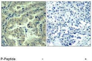 Image no. 1 for anti-Eukaryotic Translation Initiation Factor 4 Gamma, 1 (EIF4G1) (pSer1232) antibody (ABIN319277) (EIF4G1 antibody  (pSer1232))