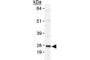 Western blot analysis of SAT1 in human SAT1 transfected lysate using with SAT1 polyclonal antibody .
