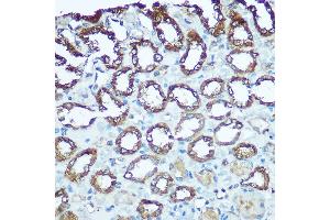 Immunohistochemistry of paraffin-embedded rat kidney using UQCRFS1 Rabbit pAb (ABIN6131106, ABIN6149963, ABIN6149965 and ABIN6222528) at dilution of 1:100 (40x lens). (UQCRFS1 antibody  (AA 79-274))