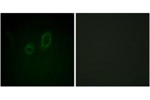 Immunofluorescence analysis of A549 cells, using Moesin/Ezrin/Radixin (Phospho-Thr558) Antibody. (Moesin/ezrin/radixin (AA 524-573), (pThr558) antibody)