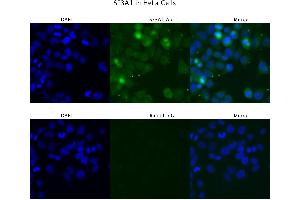 Sample Type :  HeLa   Primary Antibody Dilution:  4 ug/ml   Secondary Antibody :  Anti-rabbit Alexa 546   Secondary Antibody Dilution:  2 ug/ml   Gene Name :  SF3A1 (SF3A1 antibody  (N-Term))