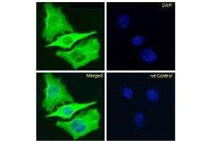 Immunofluoresence staining of fixed HeLa cells with anti-Beta-tubulin antibody S11B. (Recombinant TUBB antibody)