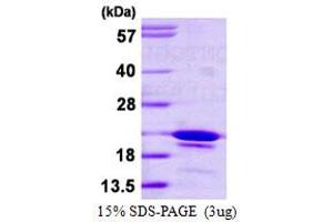 SDS-PAGE (SDS) image for SYF2 Homolog, RNA Splicing Factor (SYF2) (AA 94-243) protein (His tag) (ABIN667595) (SYF2 Protein (AA 94-243) (His tag))