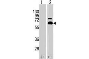 Western blot analysis of RPS6KB1 (arrow) using RPS6KB1 polyclonal antibody .