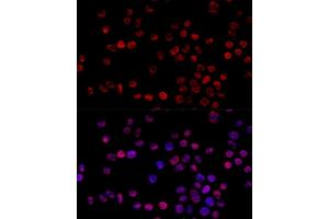Immunofluorescence analysis of 293T cells using HNRNPH1 Polyclonal Antibody (ABIN6133752, ABIN6141911, ABIN6141912 and ABIN7101789) at dilution of 1:100 (40x lens). (HNRNPH1 antibody)