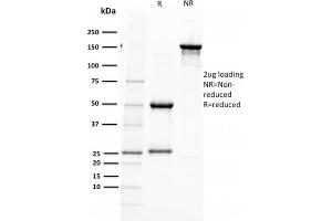 SDS-PAGE Analysis Purified PAX5 Mouse Monoclonal Antibody (PAX5/2595).