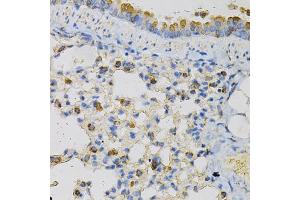 Immunohistochemistry of paraffin-embedded mouse lung using NPC2 Antibody (ABIN5973141) at dilution of 1/100 (40x lens). (NPC2 antibody)