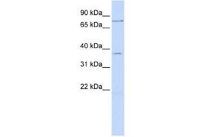 ZNF264 antibody used at 0. (ZNF264 antibody  (N-Term))