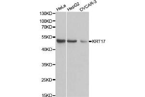 Western blot analysis of extracts of various cell lines, using KRT17 antibody. (KRT17 antibody  (AA 133-432))
