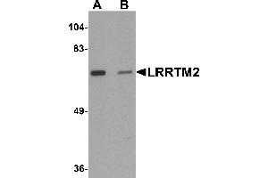 Western Blotting (WB) image for anti-Leucine Rich Repeat Transmembrane Neuronal 2 (LRRTM2) (C-Term) antibody (ABIN1030497) (LRRTM2 antibody  (C-Term))