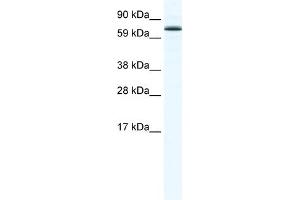 WB Suggested Anti-FOXO6 Antibody Titration:  1. (Foxo6 antibody  (N-Term))