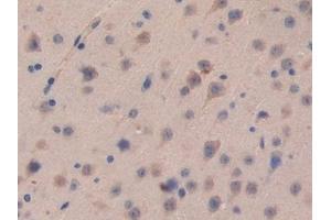 Detection of CDH16 in Mouse Brain Tissue using Polyclonal Antibody to Cadherin 16 (CDH16) (Cadherin-16 antibody  (AA 353-617))