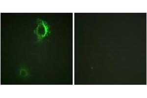 Immunofluorescence analysis of HepG2 cells, using CD5 (Phospho-Tyr453) Antibody. (CD5 antibody  (pTyr453))