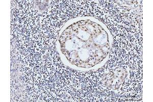 IHC analysis of KIFC1 using anti-KIFC1 antibody (ABIN7599523).