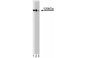 Western blot analysis of P-Cadherin on A431 cell lysate. (P-Cadherin antibody  (AA 72-259))