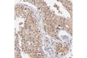 Immunohistochemical staining of human testis with UBE2E3 polyclonal antibody  shows cytoplasmic and nuclear positivity in cells in seminiferus ducts. (UBE2E3 antibody)