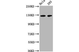 Western Blot Positive WB detected in: Hela whole cell lysate, 293 whole cell lysate All lanes: CD146 antibody at 1:500 Secondary Goat polyclonal to Mouse IgG at 1/50000 dilution Predicted band size: 72, 58 kDa Observed band size: 120 kDa (MCAM antibody  (AA 50-646))
