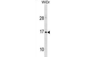 Western Blotting (WB) image for anti-Hemoglobin, zeta (HBZ) antibody (ABIN3001037) (HBZ antibody)