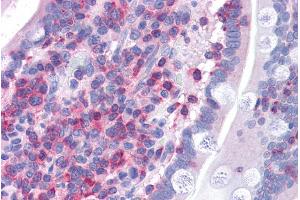 ABIN185286 (3. (FNBP1 antibody  (Internal Region))