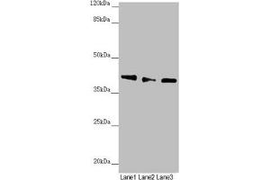 Western blot All lanes: DYNC2LI1 antibody at 1. (DYNC2LI1 antibody  (AA 1-352))