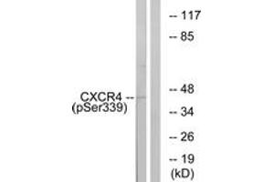 Western blot analysis of extracts from HuvEc cells treated with etoposide 25uM 24H, using CXCR4 (Phospho-Ser339) Antibody. (CXCR4 antibody  (pSer339))