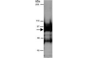 Western blot analysis of CYTSB in HeLa whole cell lysate (RIPA) using CYTSB polyclonal antibody  at 0. (NSP5 antibody  (AA 200-300))