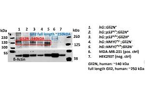 Western Blotting (WB) image for anti-GLI Family Zinc Finger 2 (GLI2) (Middle Region) antibody (ABIN2777474)