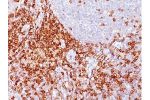 Formalin-fixed, paraffin-embedded human Spleen stained with CD43 Mouse Monoclonal Antibody (Bra7G). (CD43 antibody)