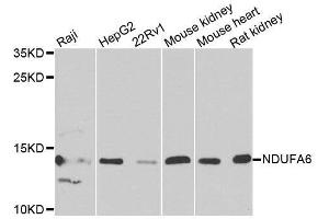 Western blot analysis of extracts of various cell lines, using NDUFA6 antibody. (NDUFA6 antibody  (AA 35-154))