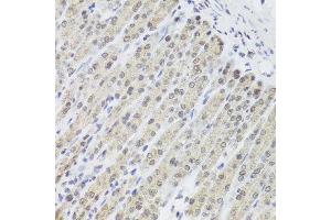Immunohistochemistry of paraffin-embedded mouse stomach using FANCL antibody at dilution of 1:100 (x40 lens). (FANCL antibody)
