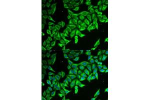 Immunofluorescence analysis of MCF-7 cells using DAP antibody (ABIN6130322, ABIN6139397, ABIN6139398 and ABIN6221757). (DAP antibody  (AA 1-102))