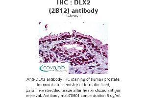Image no. 1 for anti-Distal-Less Homeobox Protein 2 (DLX2) (AA 1-110) antibody (ABIN1723650) (DLX2 antibody  (AA 1-110))