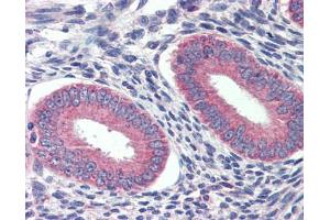 Immunohistochemistry (IHC) image for anti-Grainyhead-Like 2 (GRHL2) (Middle Region) antibody (ABIN2778358) (GRHL2 antibody  (Middle Region))