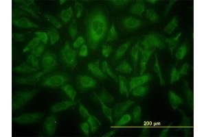 Immunofluorescence of monoclonal antibody to USP9X on HeLa cell. (USP9X antibody  (AA 1-90))