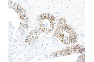 Immunohistochemistry (IHC) image for anti-alpha 1 Sodium Potassium Atpase antibody (ABIN7455086) (alpha 1 Sodium Potassium Atpase antibody)