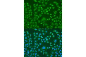 Immunofluorescence analysis of U2OS cells using EWSR1 antibody (ABIN1882293) at dilution of 1:100.