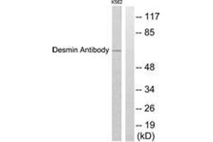 Western blot analysis of extracts from K562 cells, using Desmin Antibody. (Desmin antibody  (AA 421-470))