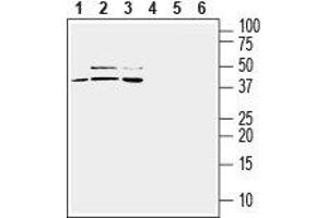 Western blot analysis of mouse BV-2 microglia (lanes 1 and 4), human U-87 MG glioblastoma (lanes 2 and 5) and human THP-1 monocytic leukemia (lanes 3 and 6) cell line lysates: - 1-3. (TREM2 antibody  (Extracellular))