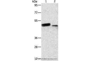 Western blot analysis of Human liver cancer and normal liver tissue, using RARB Polyclonal Antibody at dilution of 1:500 (Retinoic Acid Receptor beta antibody)
