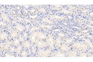 Detection of IL1b in Caprine Kidney Tissue using Polyclonal Antibody to Interleukin 1 Beta (IL1b) (IL-1 beta antibody  (AA 1-266))