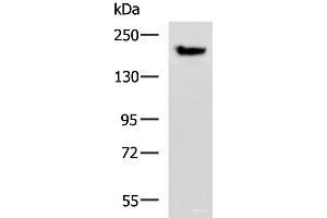 Western blot analysis of Mouse brain tissue lysate using PDS5B Polyclonal Antibody at dilution of 1:800