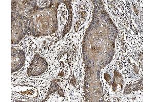 IHC analysis of PARK7/DJ1 using anti-PARK7/DJ1 antibody (ABIN7600468). (PARK7/DJ1 antibody  (AA 2-189))