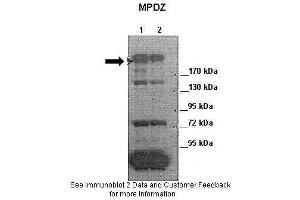 Lanes:   Lane 1: 30ug of HeLa cell lysate Lane 2: 30ug of 293T cell lysate  Primary Antibody Dilution:   1:2000  Secondary Antibody:   Anti-rabbit-HRP  Secondary Antibody Dilution:   1:5000  Gene Name:   MPDZ  Submitted by:   Jixin Dong & Yuanhong Chen,University of Nebraska (MPDZ antibody  (Middle Region))