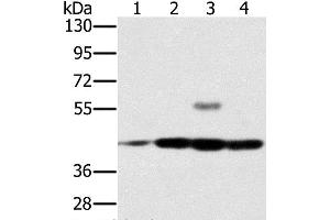 Western Blot analysis of Jurkat, Raji, K562 and hela cell using PAICS Polyclonal Antibody at dilution of 1:400 (PAICS antibody)