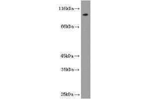 Image no. 1 for anti-Luteinizing Hormone/Choriogonadotropin Receptor (LHCGR) antibody (ABIN2937954) (LHCGR antibody)