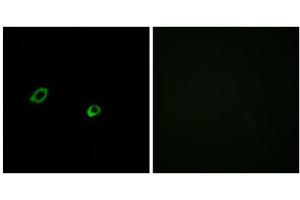 Immunofluorescence analysis of MCF-7 cells, using OR10AG1 antibody.